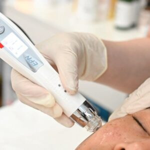 MICRONEEDLING- BEAUTY COURSE