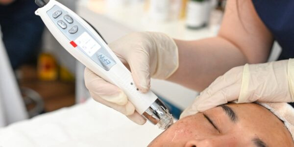 MICRONEEDLING- BEAUTY COURSE
