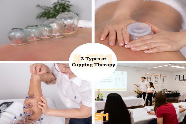 Myofascial & Traditional Flame Cupping Therapies Course
