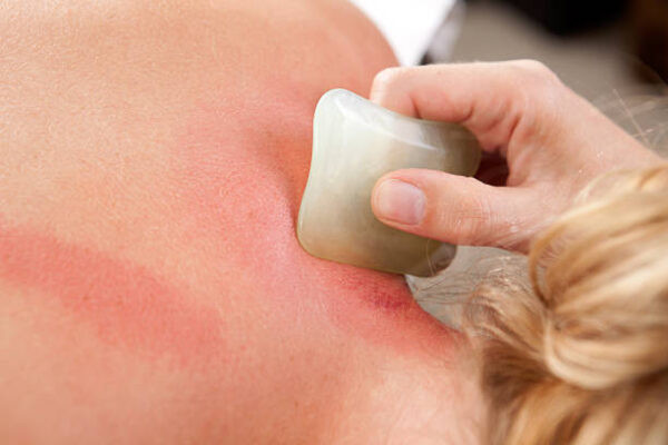 Gua Sha Massage Course